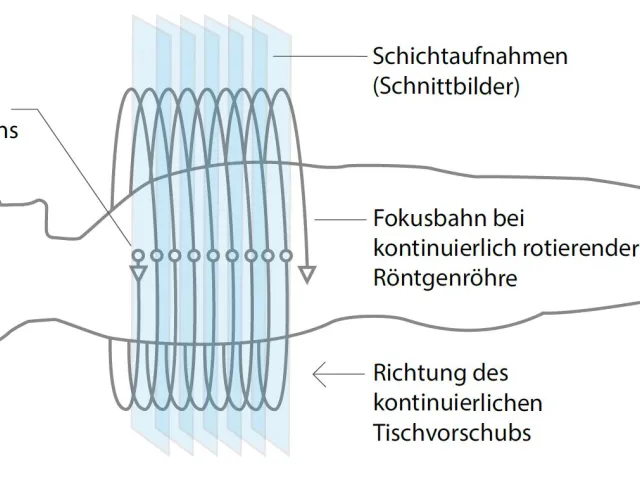 Prinzip der Thoraxuntersuchung mittels Kernspintomographie / Magnetresonanztomographie (MRT)