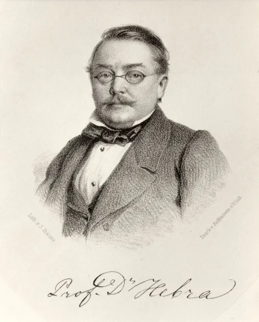 Ferdinand von Hebra (1816–1880), Medizin, Dermatologie, um 1850
