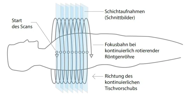 Prinzip der Thoraxuntersuchung mittels Kernspintomographie / Magnetresonanztomographie (MRT)