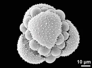 Das Rasterelektronenmikroskop (REM) bildet Oberflächenstrukturen ab: Pollen-Tetrade vom Kap-Sonnentau (Drosera capensis), au…