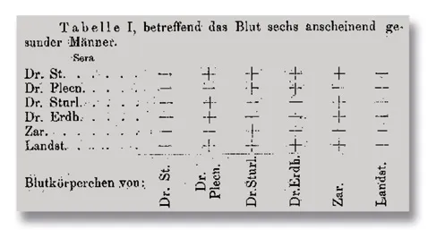 Tabelle aus Karl Landsteiners Über Agglutinationserscheinungen normalen menschlichen Blutes. Im Reagenzglas untersuchte er d…